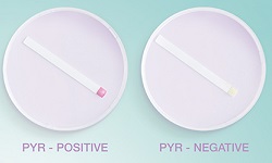 Pyrrolidonyl Arylamidase test, PYR